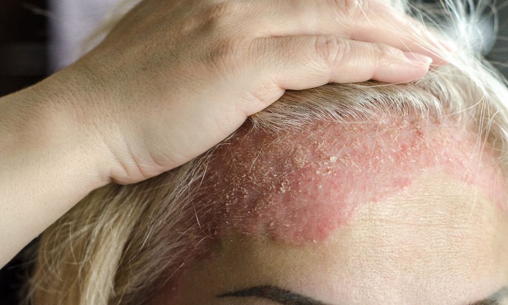 Amplia gama de servicios en dermatología