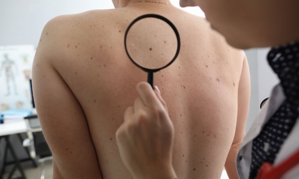 Consulta Dermatológica