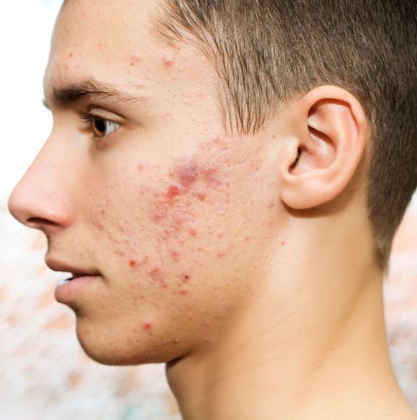 Expertos en el Cuidado de la Piel Infantil