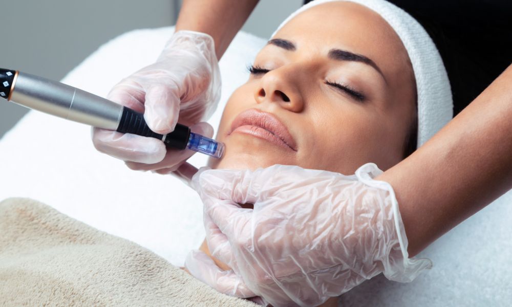 Mesoterapia Facial