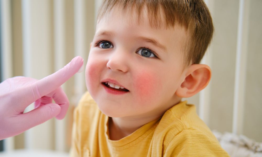 Por Qué Elegir a Nuestro Dermatólogo Pediatra en Panamá