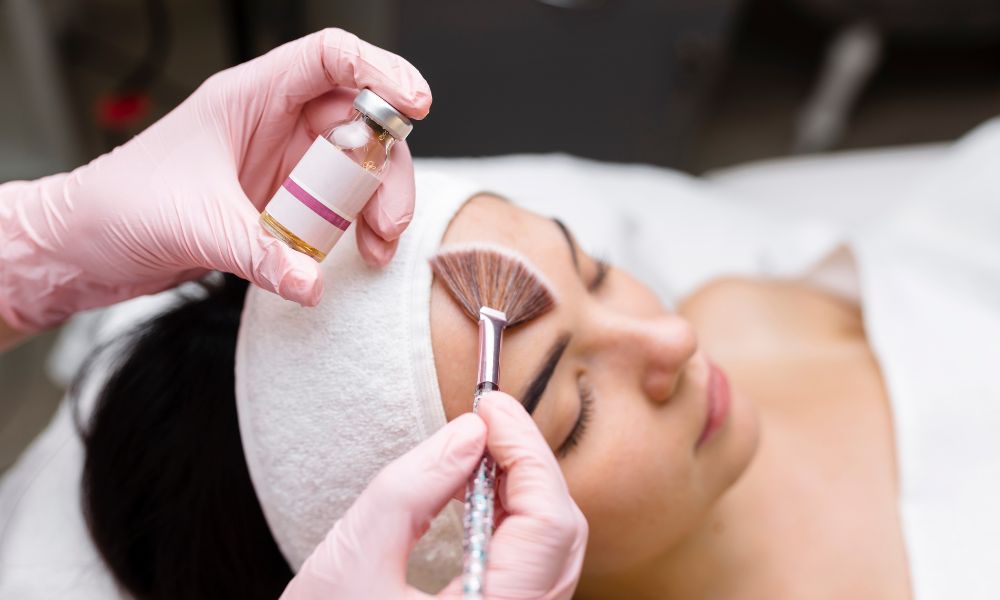 Proceso del tratamiento de peeling
