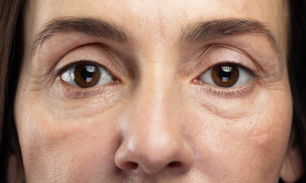 Tercio medio facial