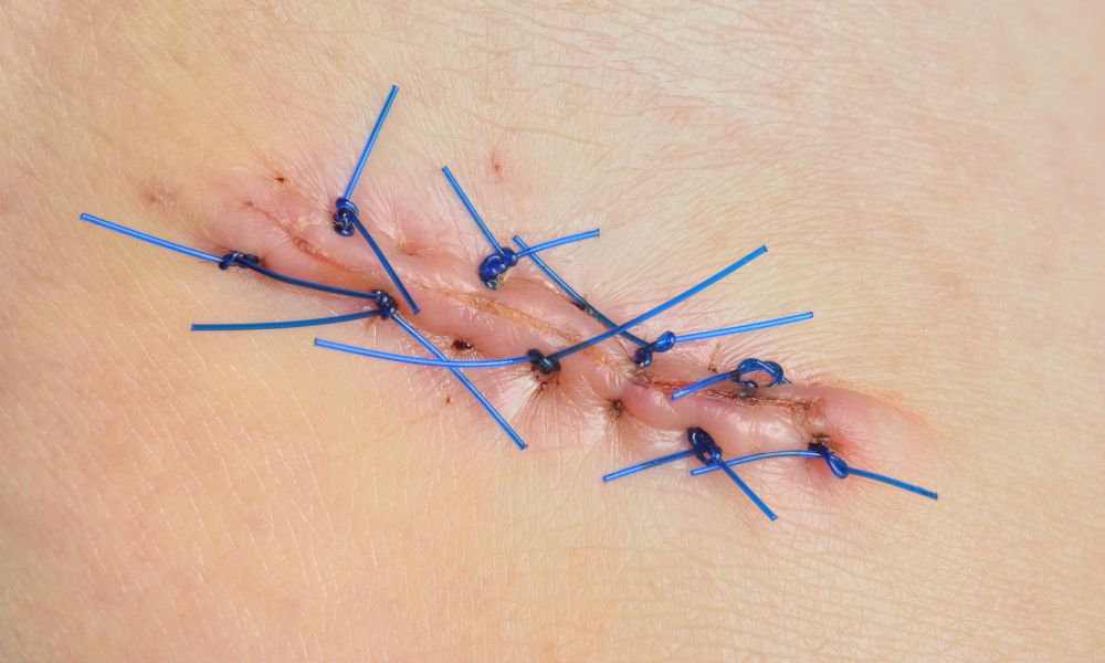 Beneficios Biopsia de Piel DERMEC