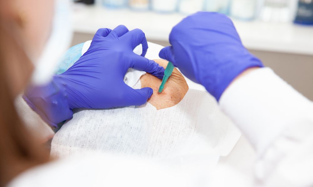 Beneficios de Realizarse una Biopsia de Piel en DERMEC