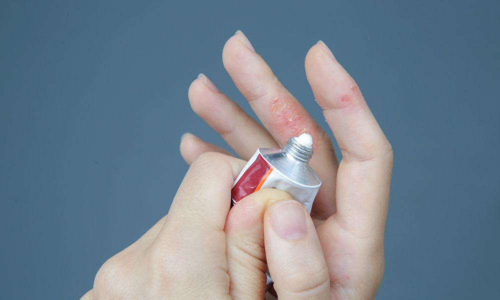 Cuidado diario para pacientes con Eccema