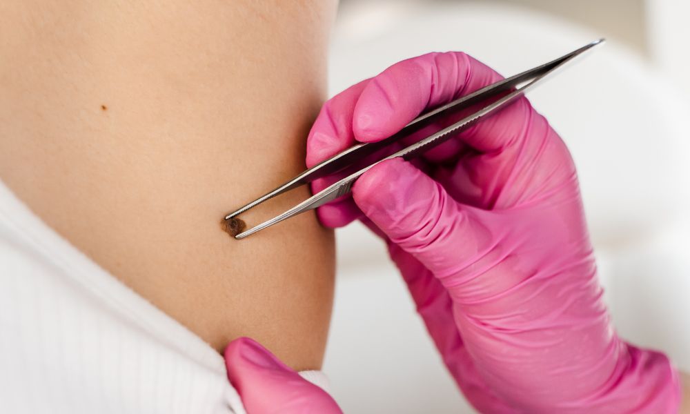 Experiencia y Especialización en Dermatología