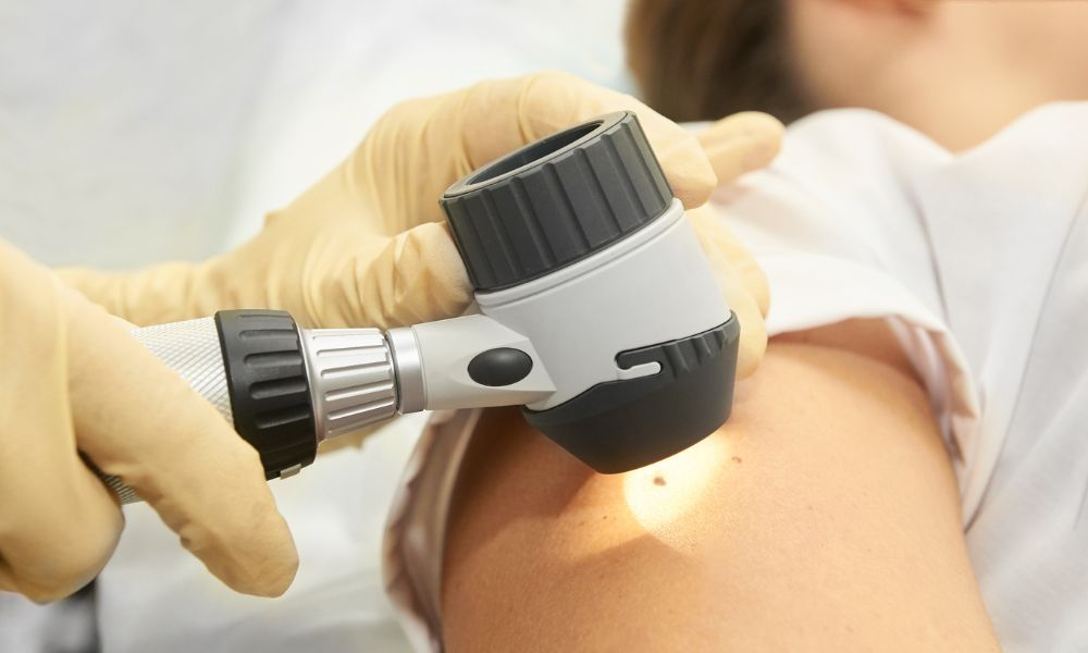 Procedimiento de Revisión de Lunares en DERMEC