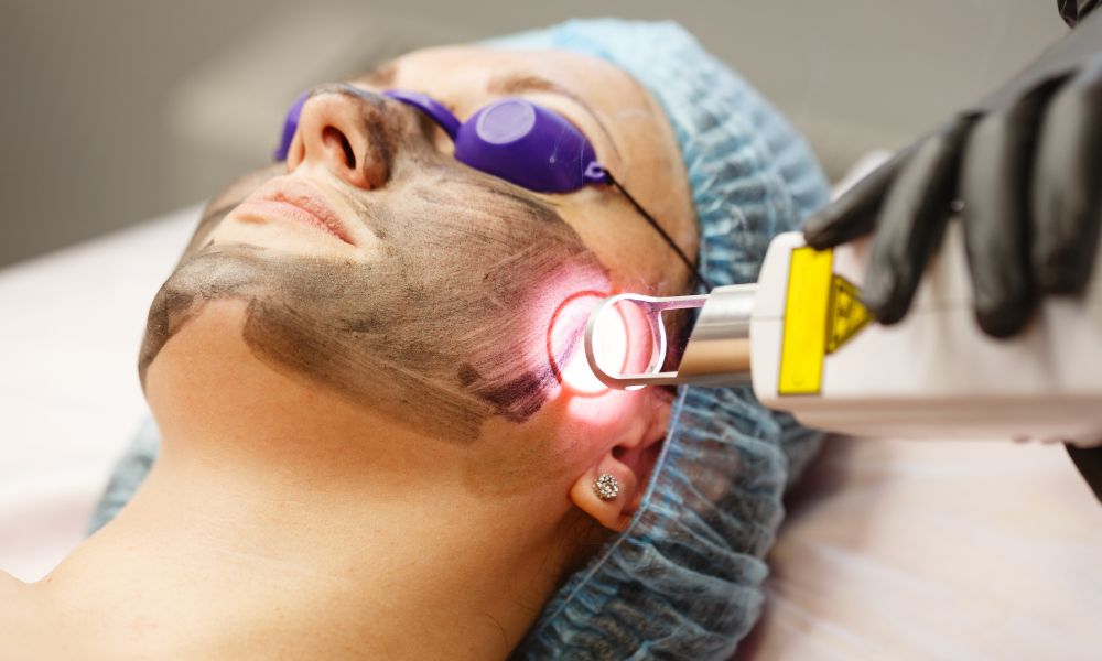 Proceso del Tratamiento de Luz Pulsada en DERMEC