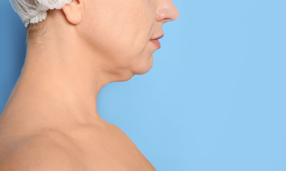 Proceso de Evaluación y Seguridad en DERMEC