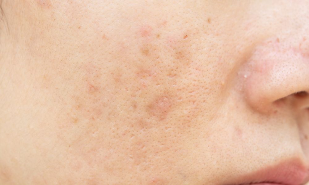 Ventajas Competitivas de DERMEC en Panamá