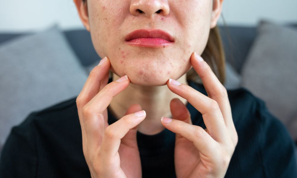 Ventajas Competitivas de DERMEC en Panamá