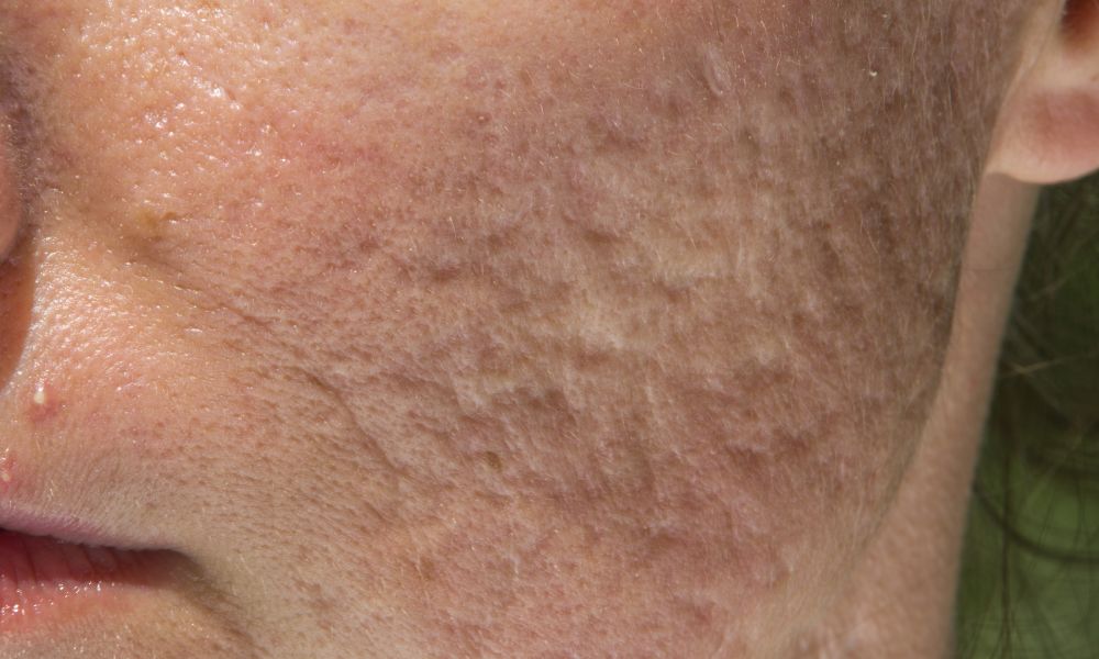 Ventajas Competitivas de DERMEC en Panamá