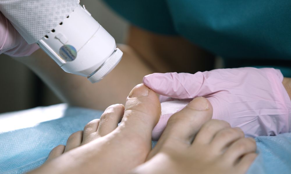 Beneficios del tratamiento con láser en DERMEC