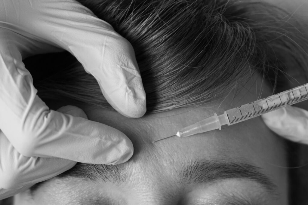 Qué es el rejuvenecimiento facial con botox