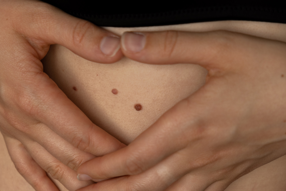 Cuándo optar por tratamientos caseros y cómo maximizar su efectividad