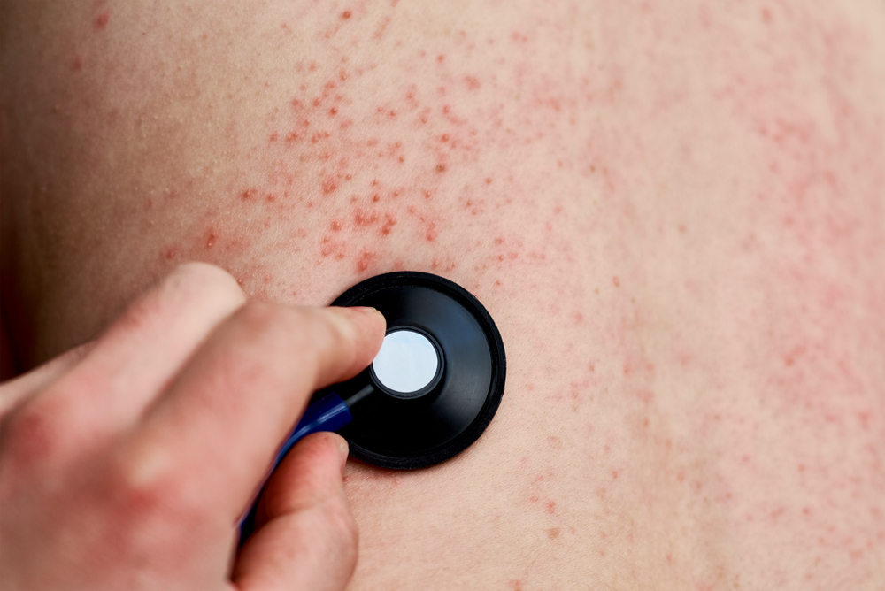 Supera la irritación y la inflamación que daña tu piel