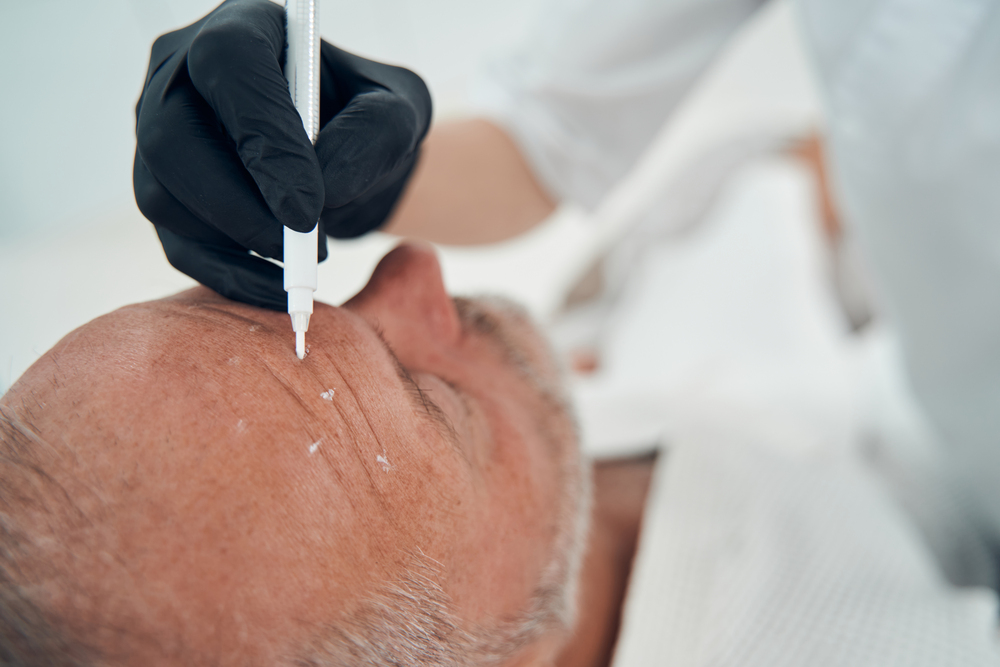 reserva tu sesión de Skin Tap y transforma tu piel