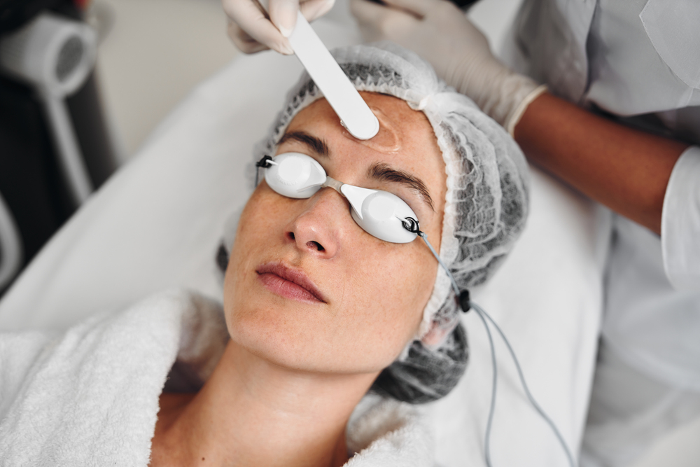 Todo lo que Necesitas Saber sobre el Peeling con Fototerapia