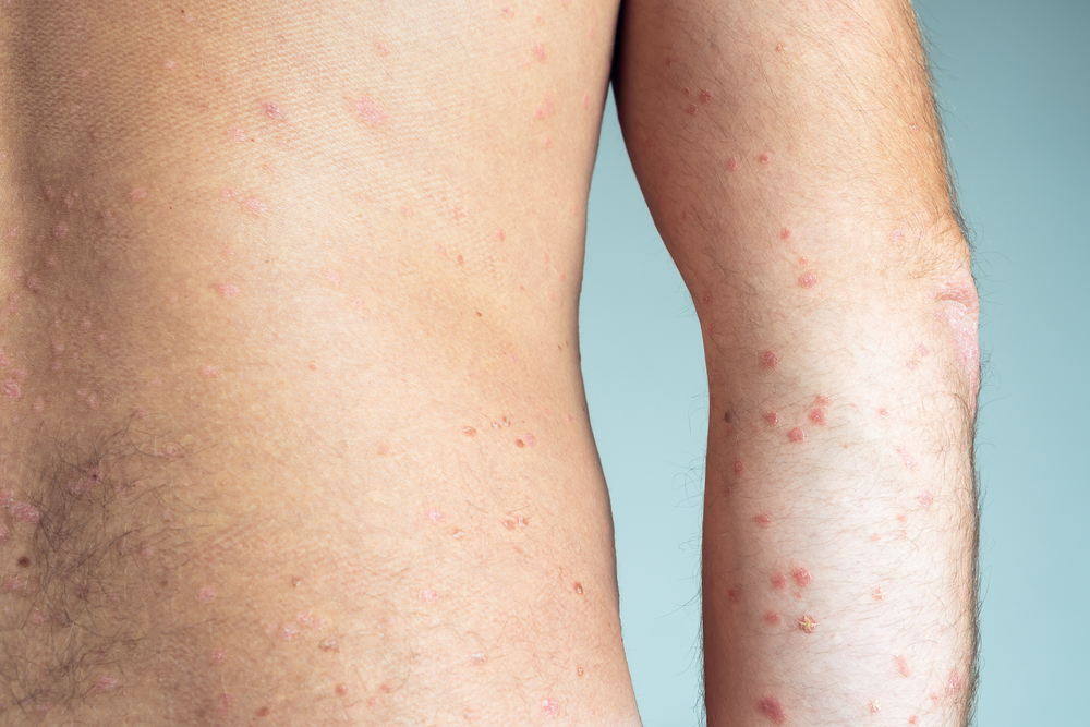 Beneficios de Optar por Nuestros Tratamientos Avanzados