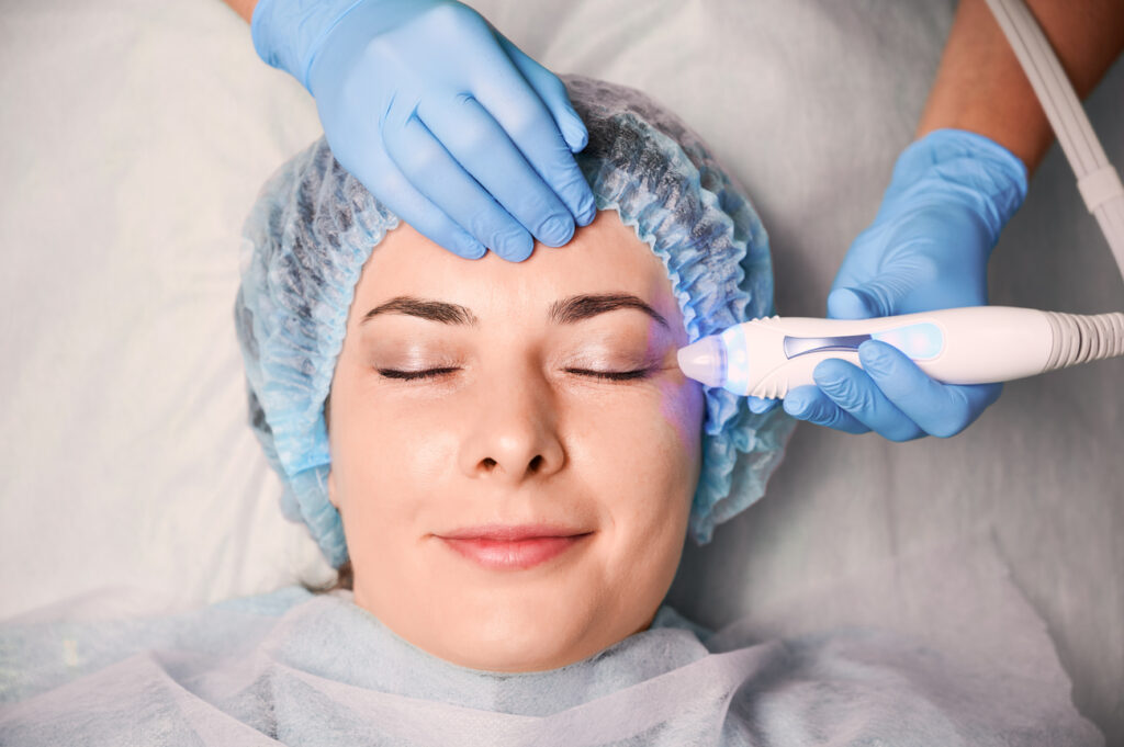 Aplicación de tecnología láser CO2 y Plasmage