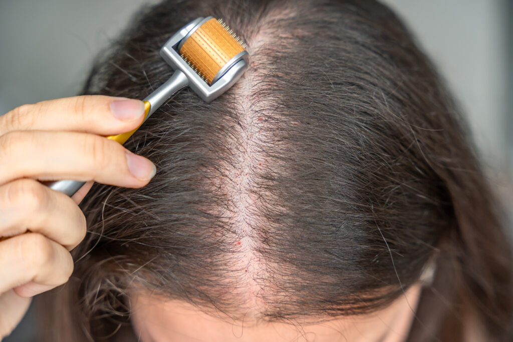 Proceso Detallado del Tratamiento en DERMEC