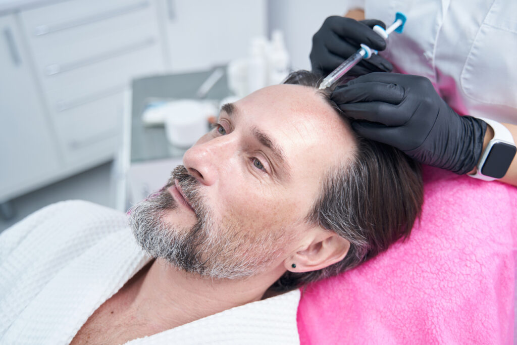 Todo sobre el Tratamiento para la Caída del Cabello