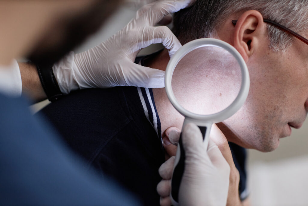 Cuándo acudir al dermatólogo señales de alarma