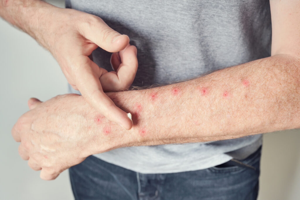 Cuidados en casa y prevención de recaídas