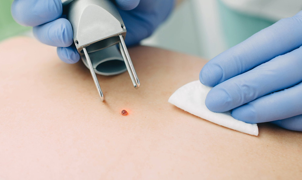 Motivos médicos para la eliminación