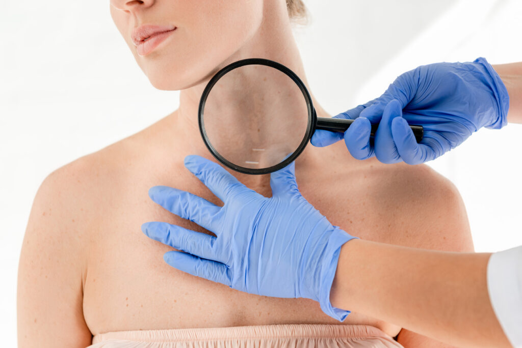 Señales de alarma cuándo consultar al dermatólogo urgentemente