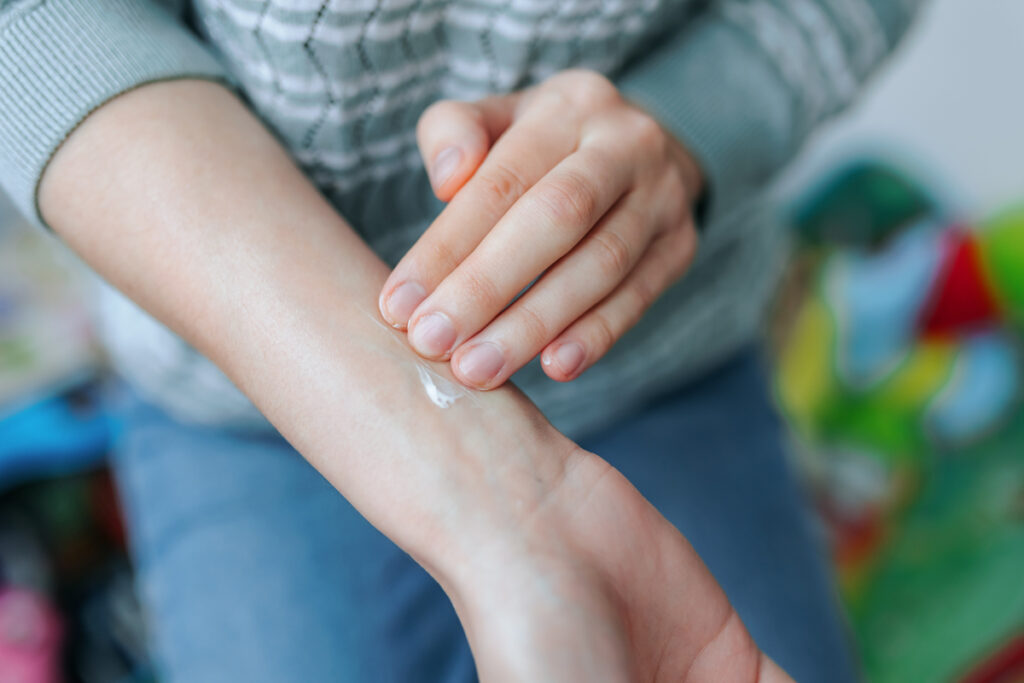 Prevención de dermatitis de contacto cómo proteger tu piel