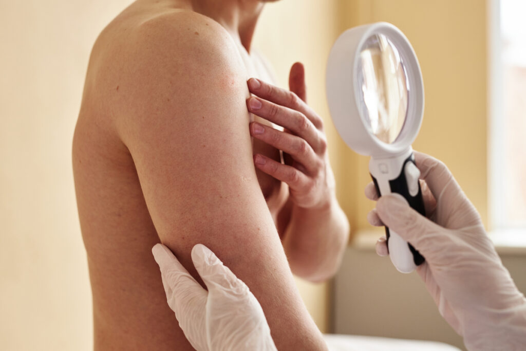 Señales de alerta cuándo consultar al dermatólogo