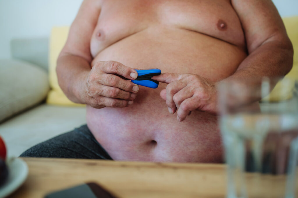 Factores que pueden empeorar los brotes de hidradenitis supurativa